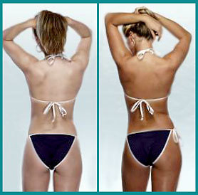 Bronze Hamptons Spray Tan at E Day Spa and Salon